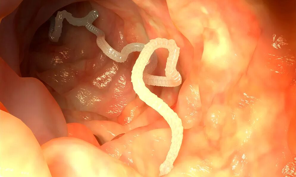 Luminal worms infect the intestines. 