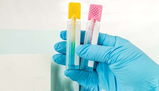 Parasites diagnostic methods
