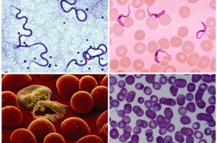 what parasites may be in human blood